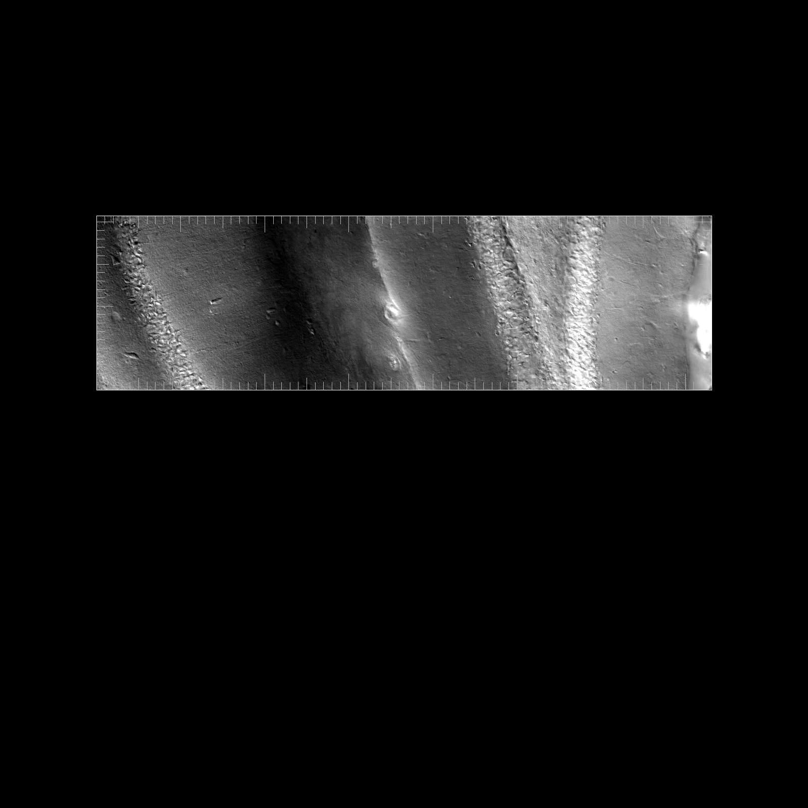 Hippocampal Brain Slice